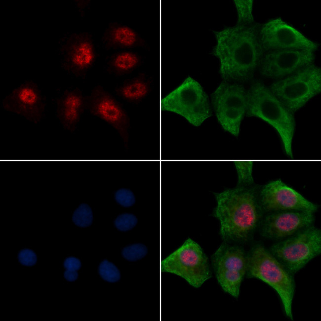Phospho-JunB (Thr255) Antibody in Immunocytochemistry (ICC/IF)
