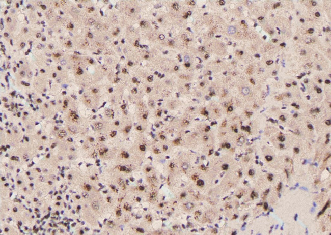 Phospho-PLCG1 (Tyr977) Antibody in Immunohistochemistry (Paraffin) (IHC (P))