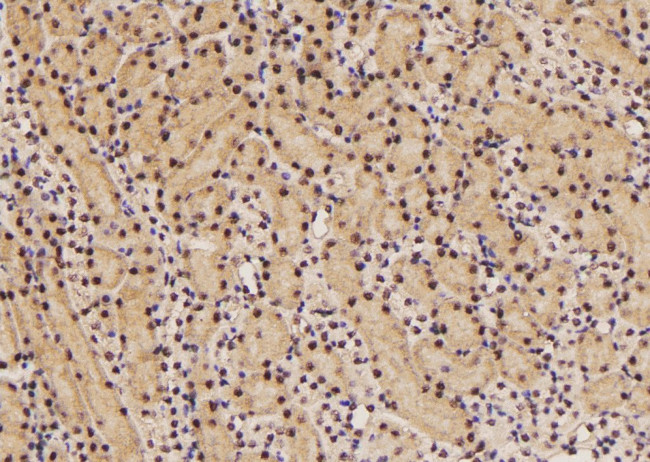 Phospho-eIF2 beta (Tyr298) Antibody in Immunohistochemistry (Paraffin) (IHC (P))