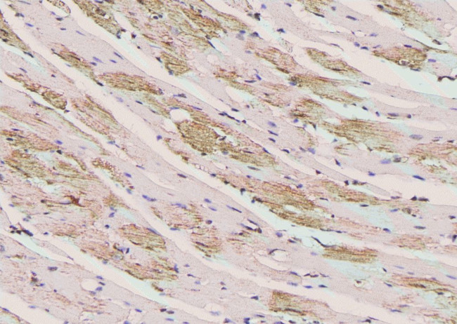 Phospho-ErbB3 (Ser686) Antibody in Immunohistochemistry (Paraffin) (IHC (P))