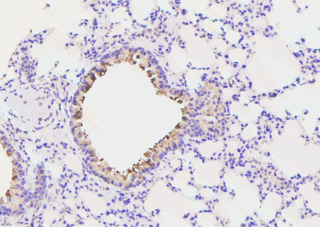Phospho-c-Cbl (Ser804) Antibody in Immunohistochemistry (Paraffin) (IHC (P))