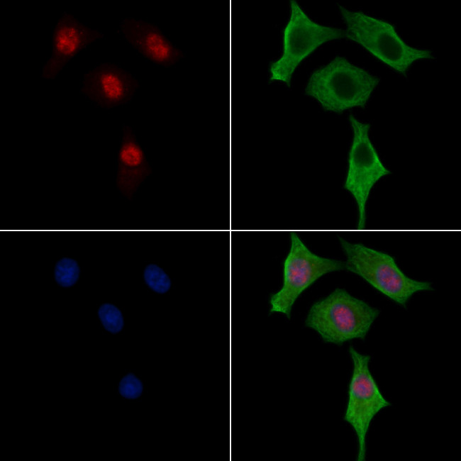 Phospho-GATA3 (Ser369) Antibody in Immunocytochemistry (ICC/IF)