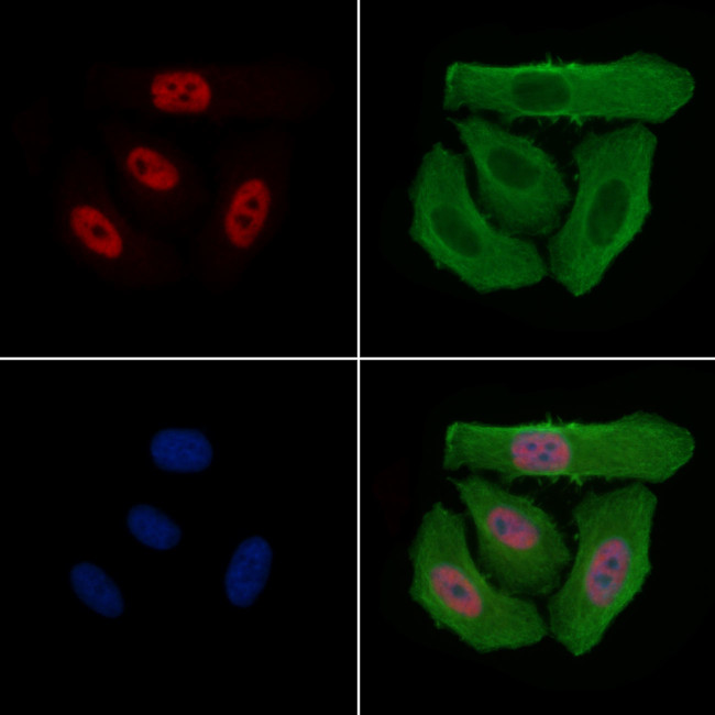 Phospho-RNA pol II CTD (Ser2, Ser5) Antibody in Immunocytochemistry (ICC/IF)