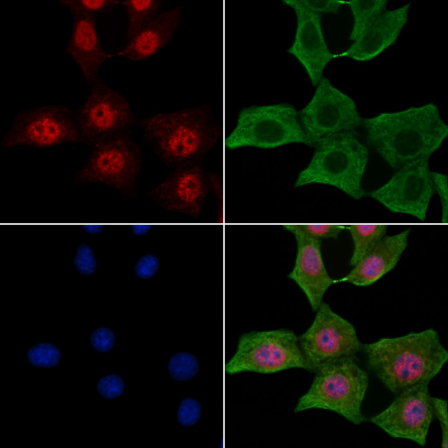 Phospho-Dnmt1 (Ser84) Antibody in Immunocytochemistry (ICC/IF)