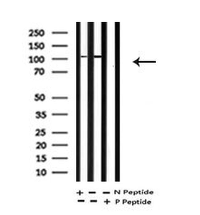Phospho-EphA2 (Tyr594) Antibody in Western Blot (WB)