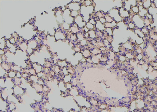 Phospho-EphA2 (Tyr772) Antibody in Immunohistochemistry (Paraffin) (IHC (P))