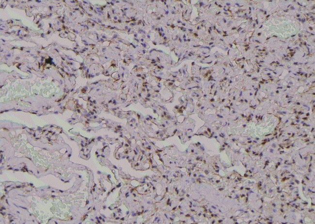Phospho-MARCKS (Ser170) Antibody in Immunohistochemistry (Paraffin) (IHC (P))