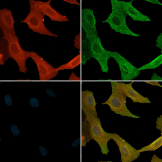 Phospho-Axl (Tyr703) Antibody in Immunocytochemistry (ICC/IF)