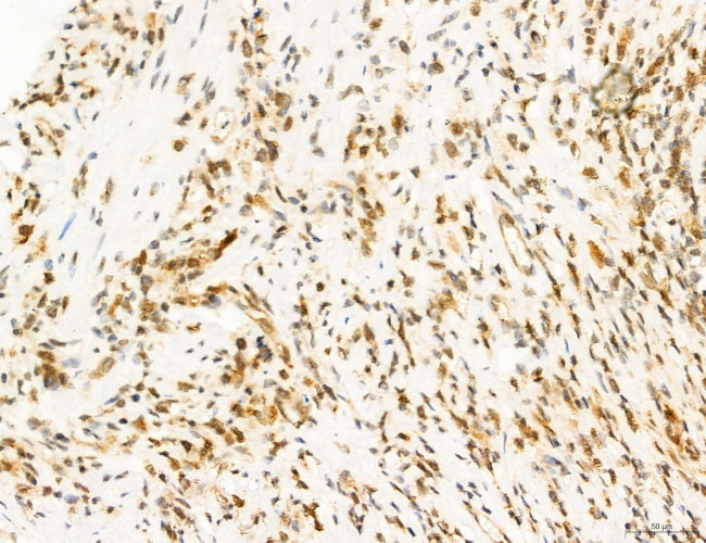 Phospho-FLT3 (Tyr631) Antibody in Immunohistochemistry (Paraffin) (IHC (P))