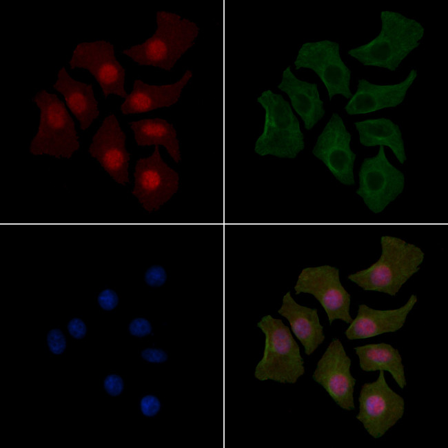 Phospho-STAT3 (Tyr539) Antibody in Immunocytochemistry (ICC/IF)