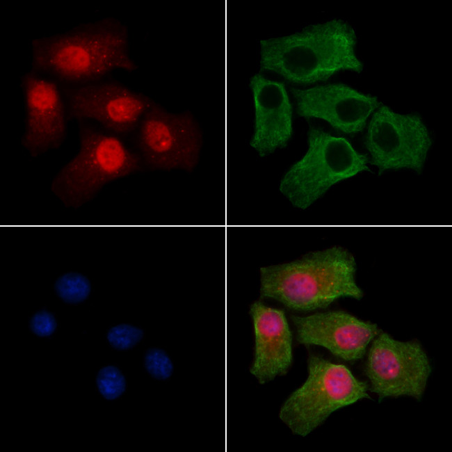 Phospho-mTOR (Ser2454) Antibody in Immunocytochemistry (ICC/IF)