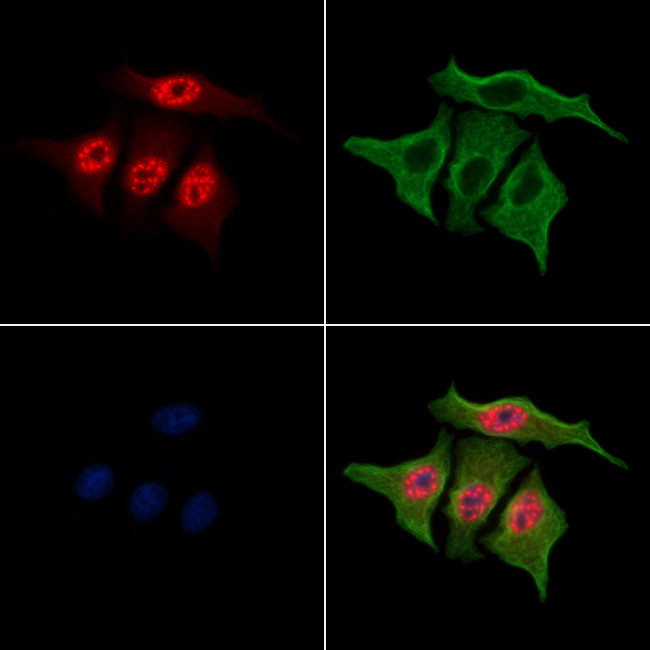 Phospho-MAPKAPK2 (Thr334) Antibody in Immunocytochemistry (ICC/IF)