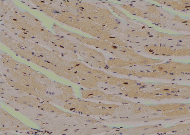 Phospho-MAPKAPK2 (Thr221, Thr222) Antibody in Immunohistochemistry (Paraffin) (IHC (P))