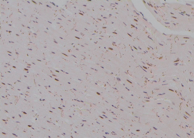 Phospho-TSC2 (Thr938) Antibody in Immunohistochemistry (Paraffin) (IHC (P))
