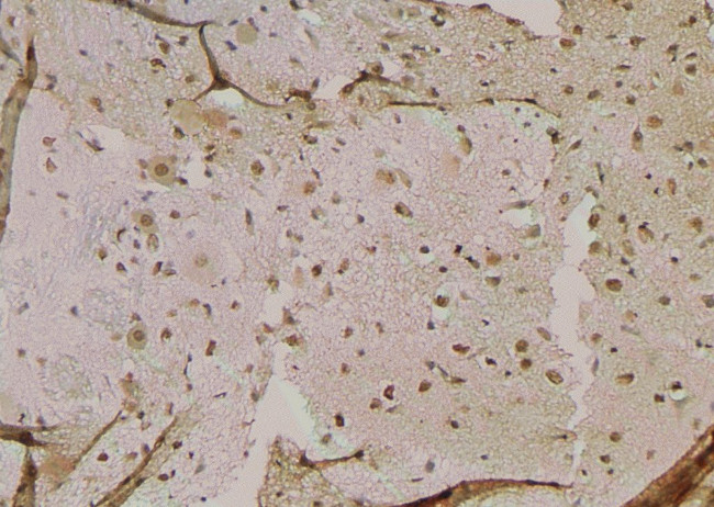 Phospho-GSK3B (Ser25) Antibody in Immunohistochemistry (Paraffin) (IHC (P))