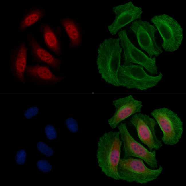 Phospho-RSK2 (Ser369) Antibody in Immunocytochemistry (ICC/IF)