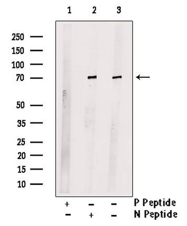 Phospho-LIMK2 (Ser293) Antibody in Western Blot (WB)