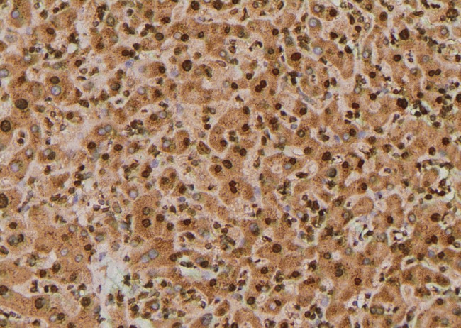 Phospho-p130Cas (Tyr267) Antibody in Immunohistochemistry (Paraffin) (IHC (P))