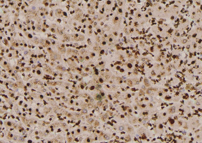Phospho-p130Cas (Tyr387) Antibody in Immunohistochemistry (Paraffin) (IHC (P))