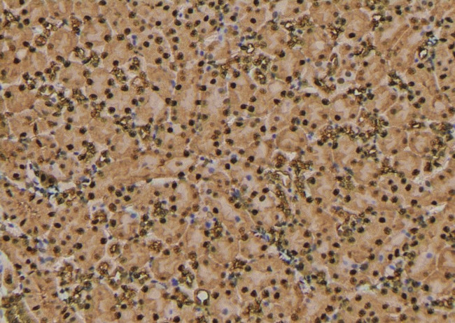 Phospho-RHOA (Thr100) Antibody in Immunohistochemistry (Paraffin) (IHC (P))
