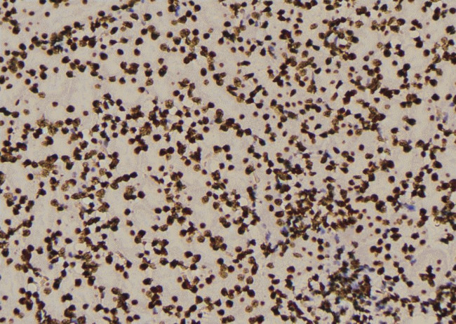 Phospho-S6 (Tyr209) Antibody in Immunohistochemistry (Paraffin) (IHC (P))