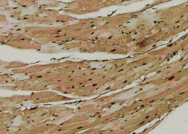 Phospho-YBX1 (Ser176) Antibody in Immunohistochemistry (Paraffin) (IHC (P))