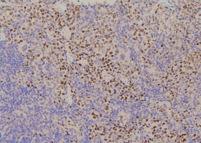 Phospho-YBX1 (Tyr162) Antibody in Immunohistochemistry (Paraffin) (IHC (P))
