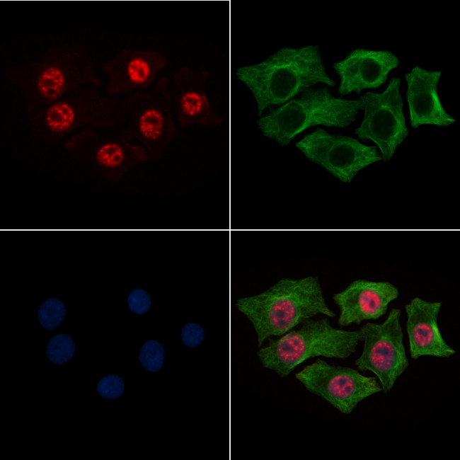 Phospho-CK2 alpha-1 (Tyr360) Antibody in Immunocytochemistry (ICC/IF)