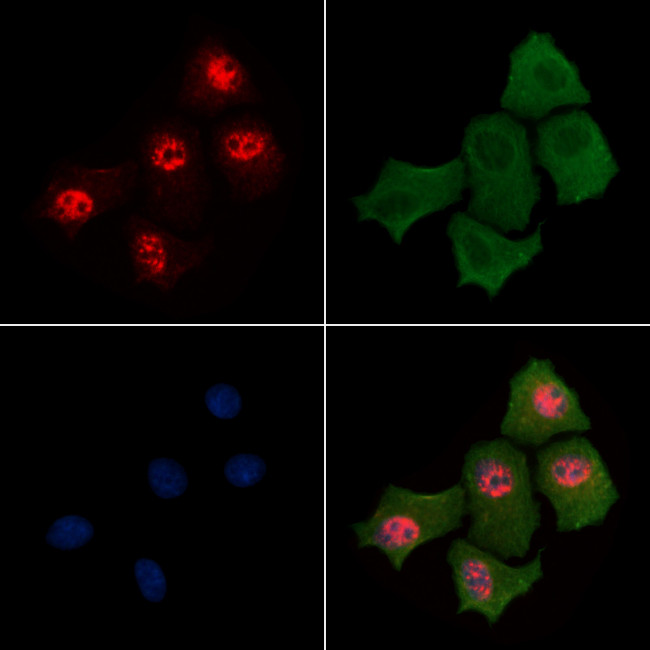 Phospho-Histone H3 (Ser58) Antibody in Immunocytochemistry (ICC/IF)
