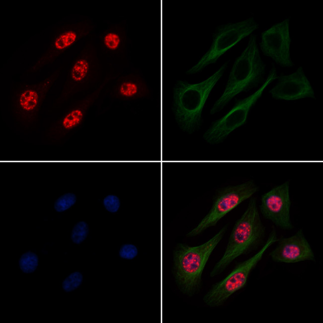 Phospho-Histone H3 (Thr12) Antibody in Immunocytochemistry (ICC/IF)