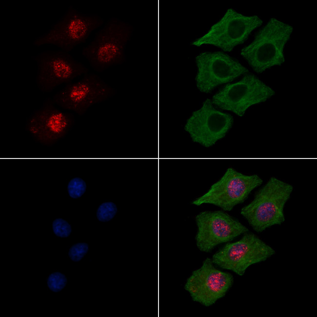 Phospho-Histone H3 (Thr81) Antibody in Immunocytochemistry (ICC/IF)