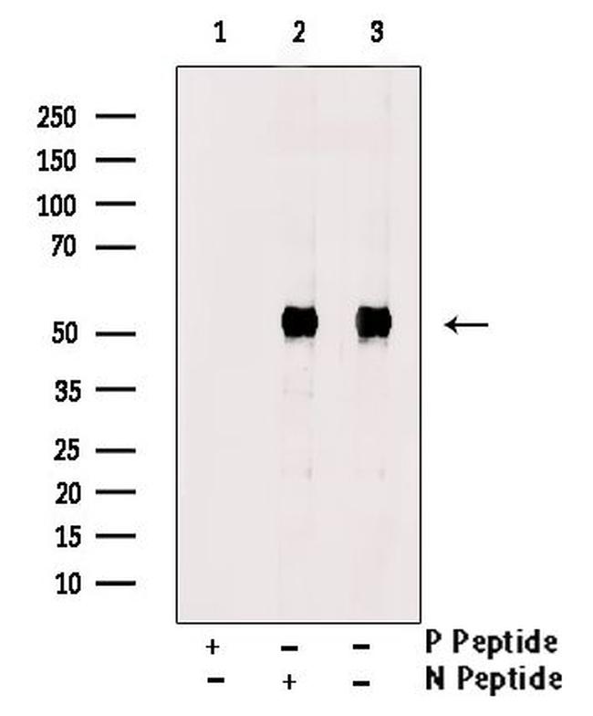 Phospho-CTDSPL2 (Ser9) Antibody in Western Blot (WB)