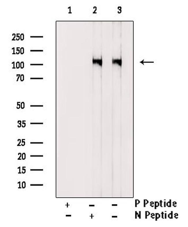 Phospho-DDR1 (Tyr520) Antibody in Western Blot (WB)