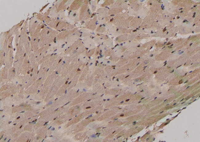 Phospho-MST2 (Ser316) Antibody in Immunohistochemistry (Paraffin) (IHC (P))