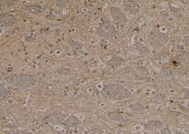 Phospho-NMDAR2B (Ser1478) Antibody in Immunohistochemistry (Paraffin) (IHC (P))