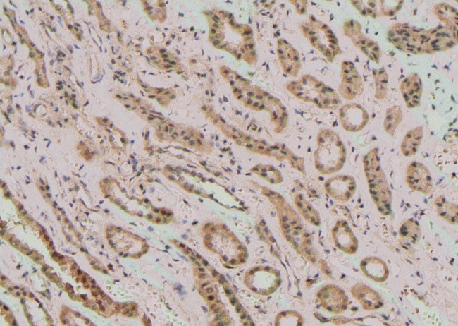 Phospho-PLD1 (Ser561) Antibody in Immunohistochemistry (Paraffin) (IHC (P))