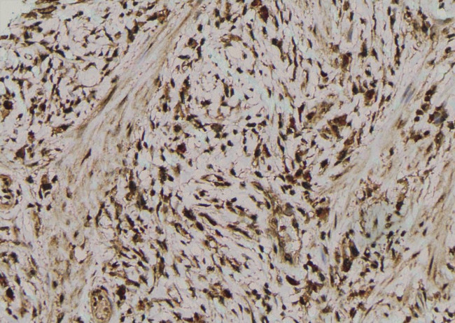 Phospho-SQSTM1 (Ser366) Antibody in Immunohistochemistry (Paraffin) (IHC (P))