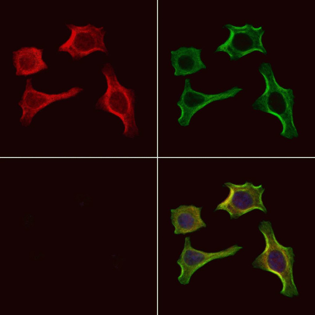 Phospho-CaMKII alpha/beta/delta (Ser235) Antibody in Immunocytochemistry (ICC/IF)