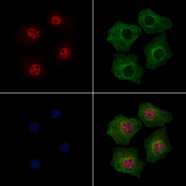 Phospho-Beclin 1 (Ser279) Antibody in Immunocytochemistry (ICC/IF)