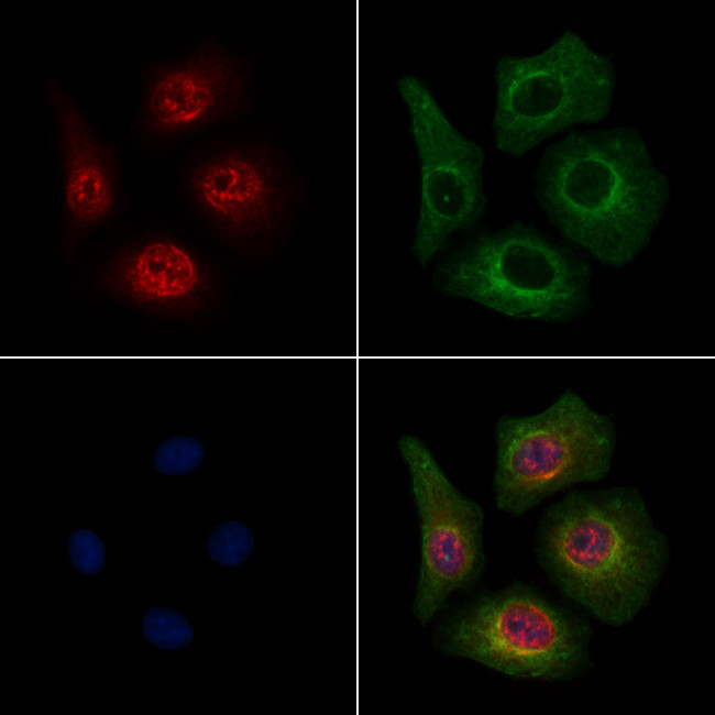 Phospho-Beclin 1 (Ser90, Ser93, Ser96) Antibody in Immunocytochemistry (ICC/IF)
