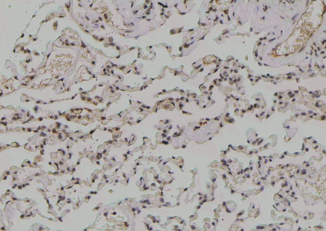 Phospho-C/EBP epsilon (Ser181) Antibody in Immunohistochemistry (Paraffin) (IHC (P))