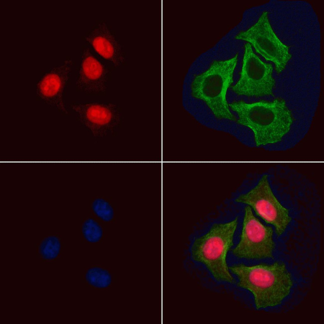 Phospho-BCL9L (Ser21 ) Antibody in Immunocytochemistry (ICC/IF)