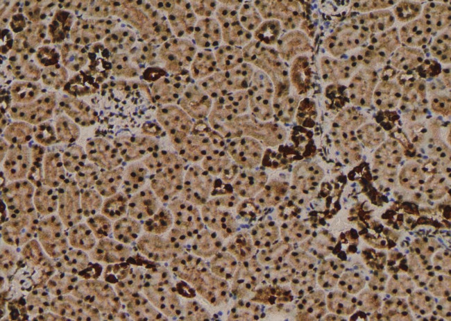 Phospho-VPS34 (Ser244, Ser249) Antibody in Immunohistochemistry (Paraffin) (IHC (P))
