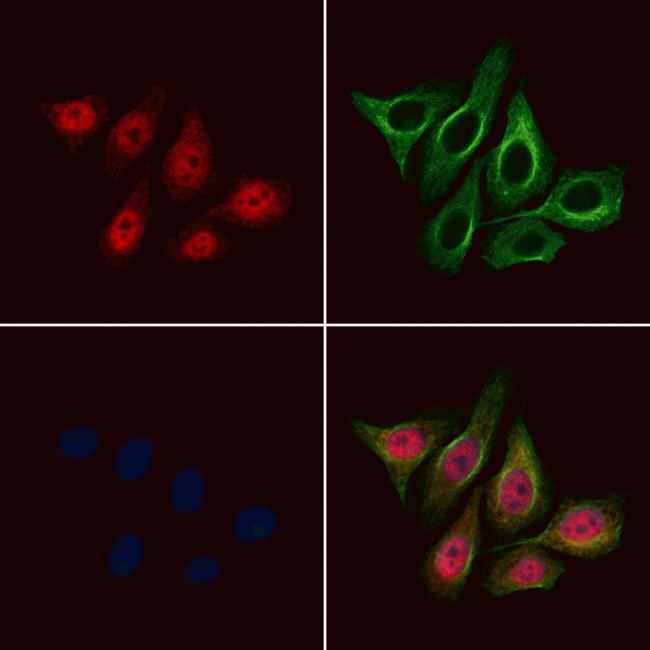 Phospho-BAP1 (Ser369) Antibody in Immunocytochemistry (ICC/IF)