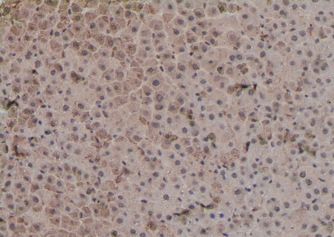 Phospho-SGK3 (Ser486) Antibody in Immunohistochemistry (Paraffin) (IHC (P))