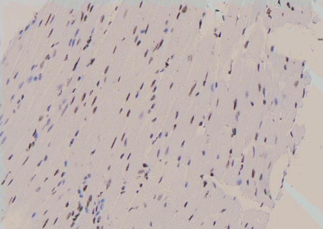 Phospho-REPS1 (Ser272) Antibody in Immunohistochemistry (Paraffin) (IHC (P))