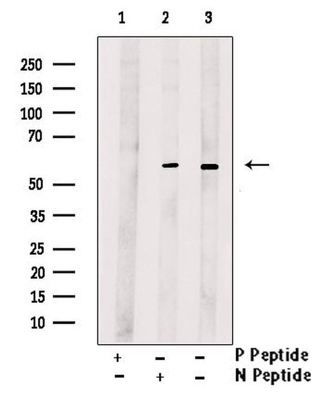 Phospho-MAPKAP1 (Ser510) Antibody in Western Blot (WB)