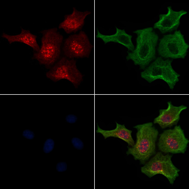 Phospho-LATS2 (Ser872) Antibody in Immunocytochemistry (ICC/IF)