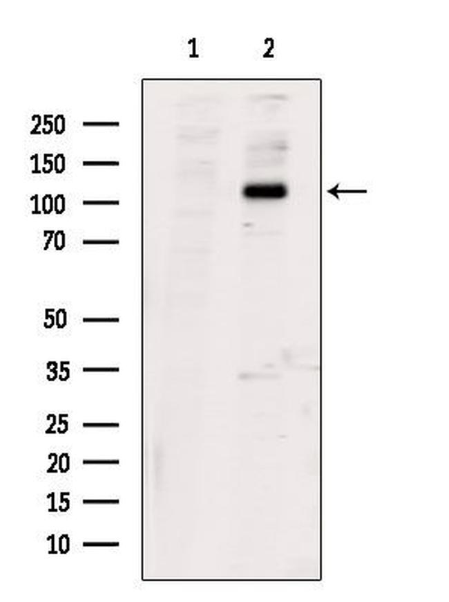 Phospho-PERK (Ser555) Antibody in Western Blot (WB)