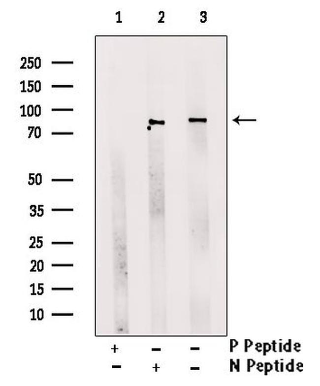 Phospho-TACC3 (Tyr560) Antibody in Western Blot (WB)